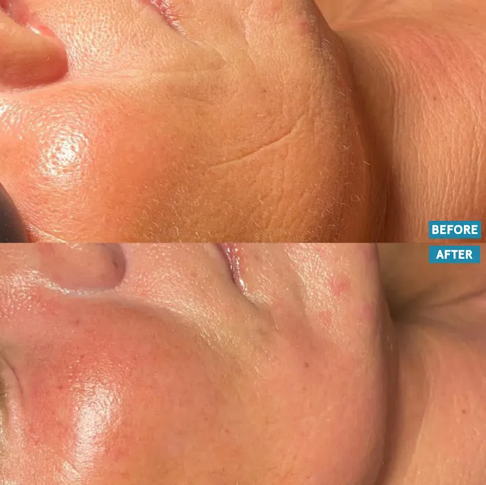 Skin Sessions LG Picture 4