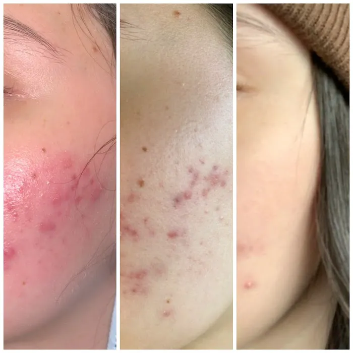 Clinically Clear® Picture 8