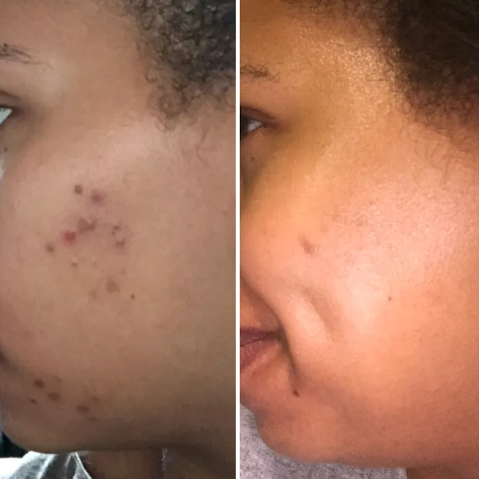 Clinically Clear® Picture 10