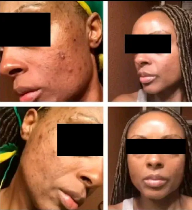 Clinically Clear® Picture 5