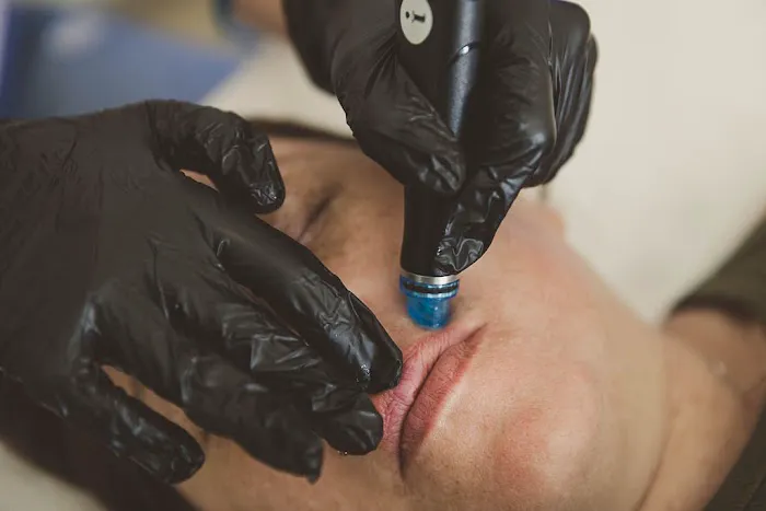 ASHLEY HAUT AESTHETICS | formerly Santa Cruz Hydrafacial Picture 5