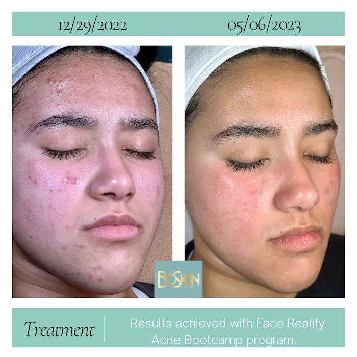 BoSkin Studio Picture 10