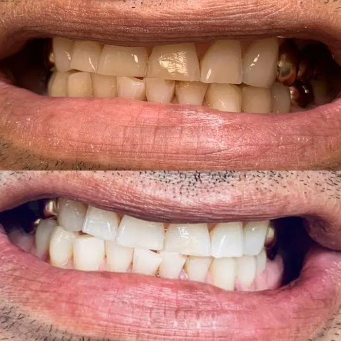 Glow Skin Bar Picture 6