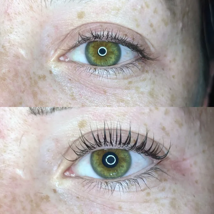 Glow Skin Bar Picture 7