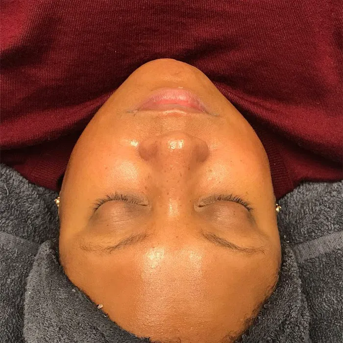 GLOWDEGA | Oakland Acne Experts & Brazilian Sugaring Picture 8