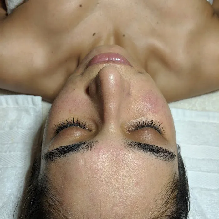 Butterfly Esthetics Picture 9