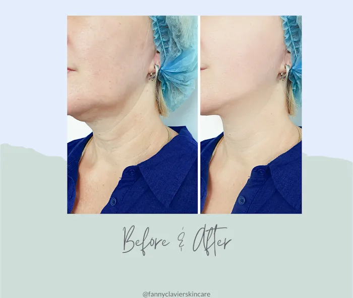 Fanny Clavier Skincare Picture 4