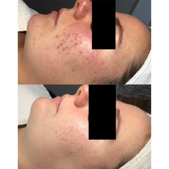 Acne Specialists of Oakland Picture 3