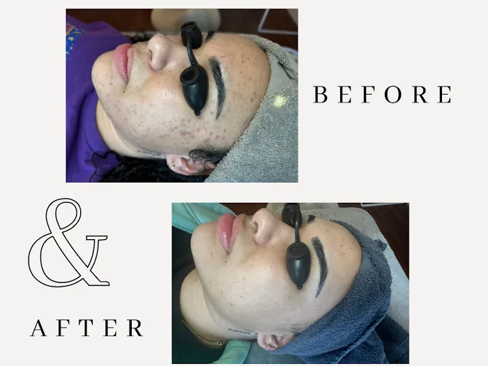 Amy Earnest Acne Specialist Picture 1