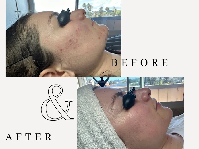 Amy Earnest Acne Specialist Picture 3