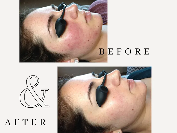 Amy Earnest Acne Specialist Picture 2