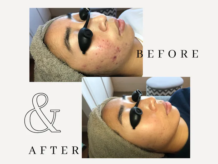 Amy Earnest Acne Specialist Picture 5