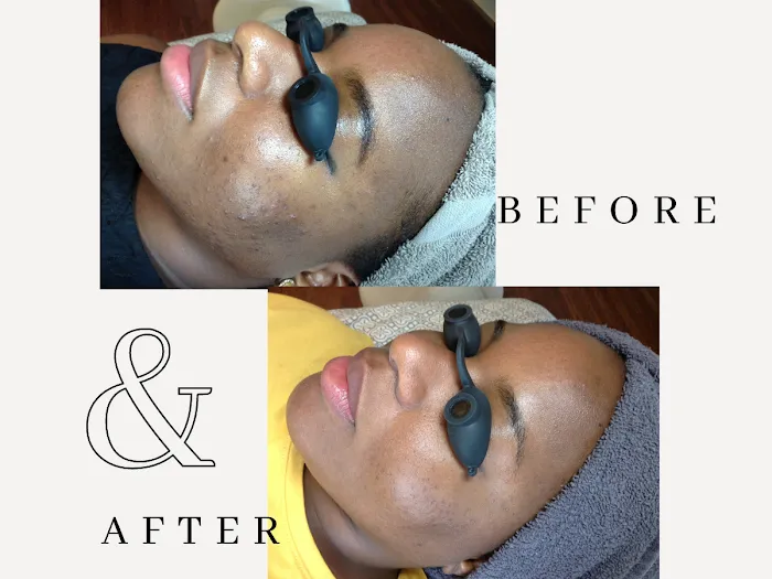 Amy Earnest Acne Specialist Picture 4