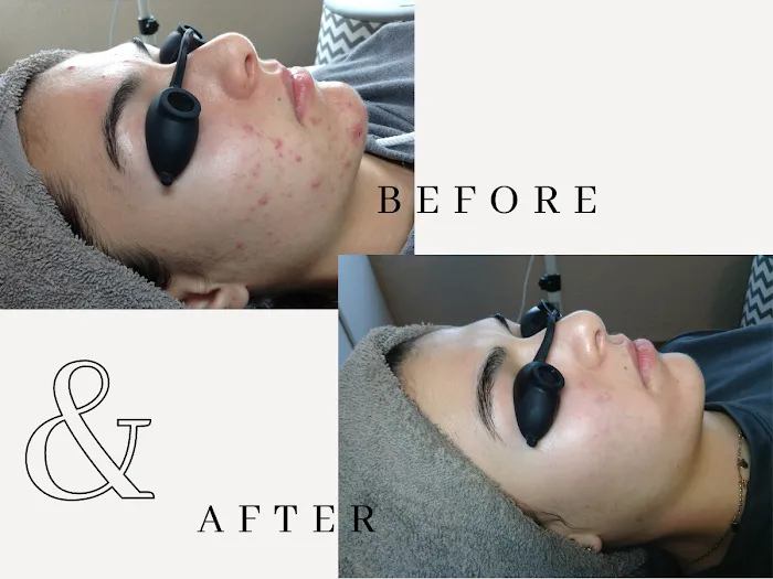 Amy Earnest Acne Specialist Picture 6