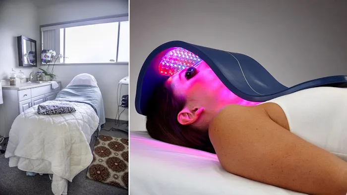 02 Skin Renu Picture 4