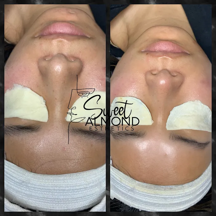 Sweet Almond Esthetics Picture 6