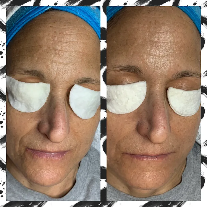 Sweet Almond Esthetics Picture 9