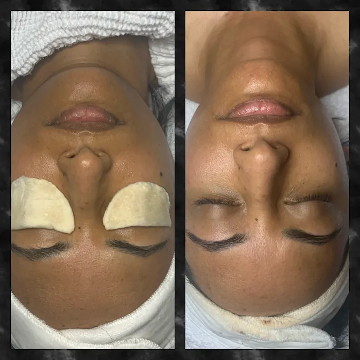 Sweet Almond Esthetics Picture 7