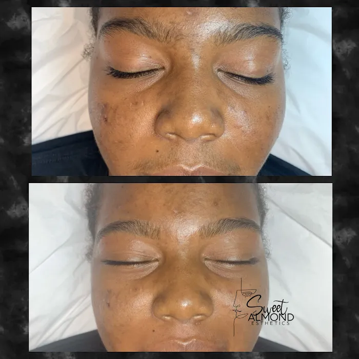 Sweet Almond Esthetics Picture 8