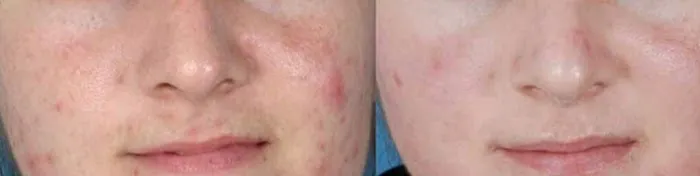 KBOI WELLNESS Picture 4