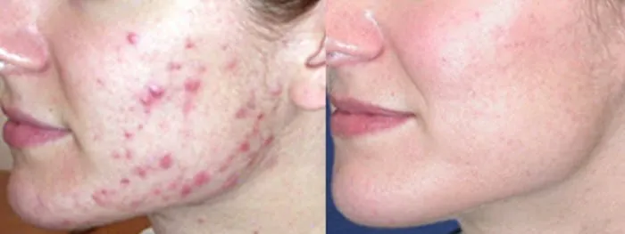 KBOI WELLNESS Picture 3