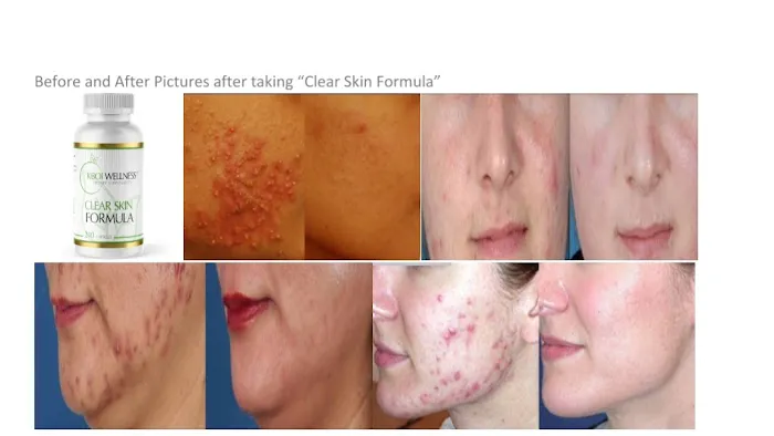 KBOI WELLNESS Picture 1