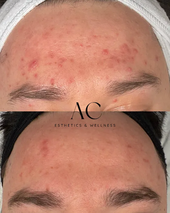 AC Esthetics & Wellness Picture 10