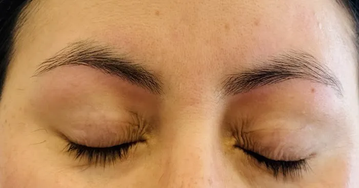 SS threading and esthetics Picture 8