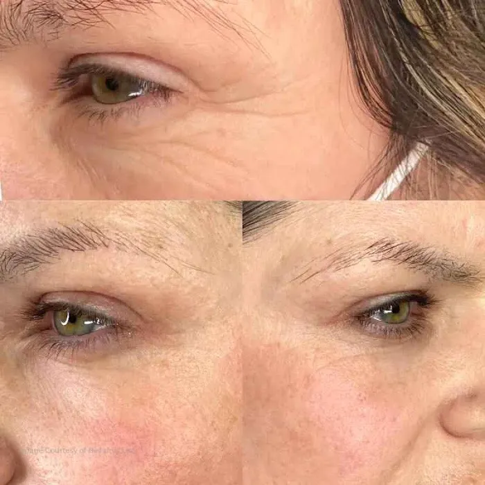 Plasmagique Picture 6