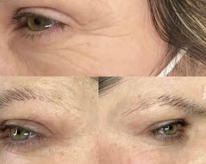 Plasmagique Picture 5