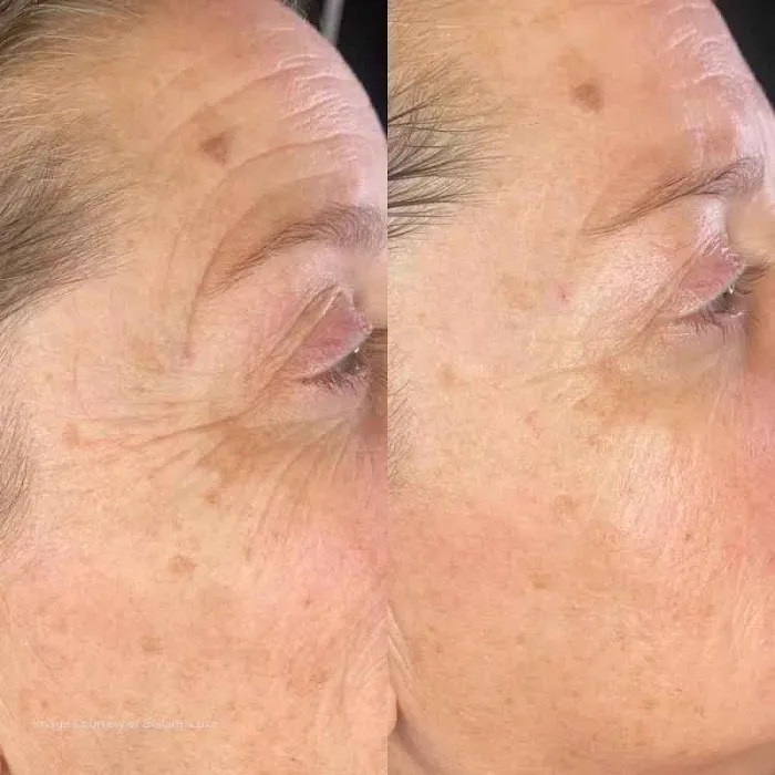 Plasmagique Picture 10