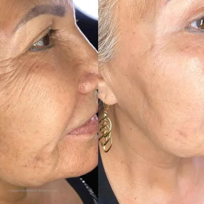 Plasmagique Picture 8