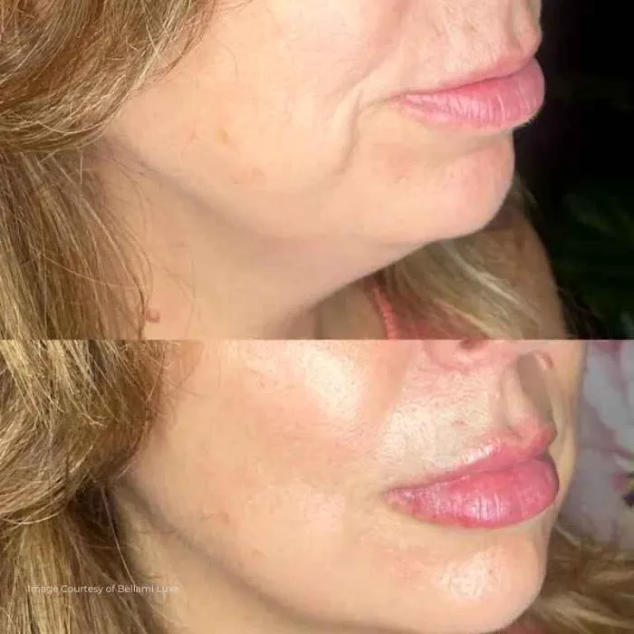 Plasmagique Picture 9