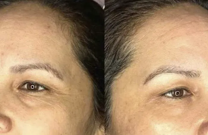 Plasmagique Picture 7