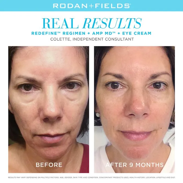 CLOSED! Carmilla Denno Rodan + Fields Independent Consultant Picture 5