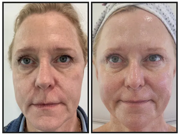 Elevate Aesthetics and Wellness Picture 4