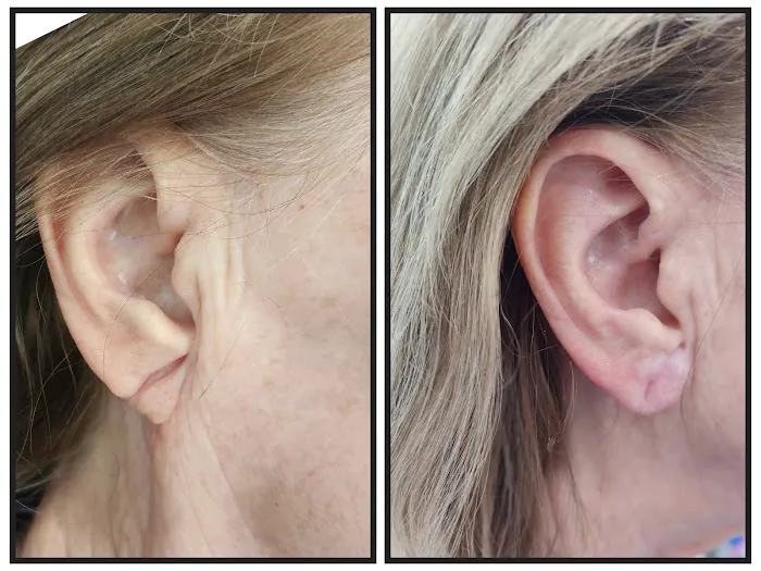 Elevate Aesthetics and Wellness Picture 1