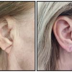 Elevate Aesthetics and Wellness