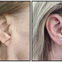 Elevate Aesthetics and Wellness ico