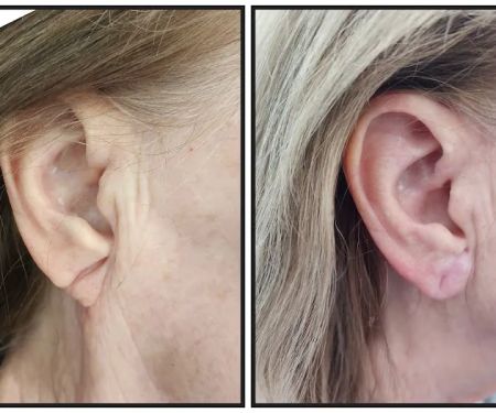 Elevate Aesthetics and Wellness