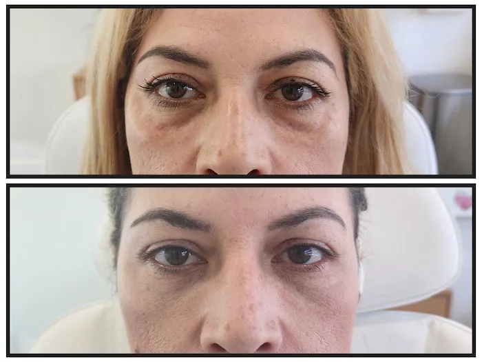 Elevate Aesthetics and Wellness Picture 5