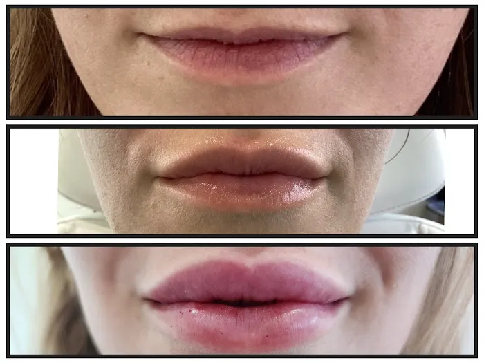 Elevate Aesthetics and Wellness Picture 6