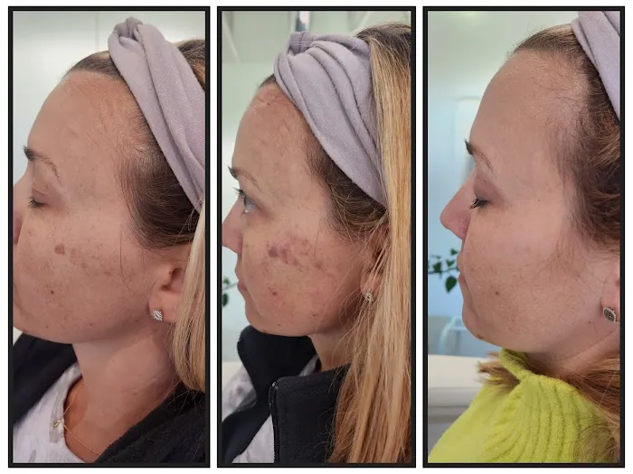 Elevate Aesthetics and Wellness Picture 8