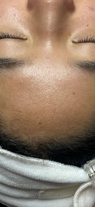 Tru Skin Acne Clinic Picture 6