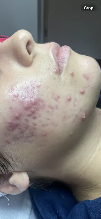 Tru Skin Acne Clinic Picture 4