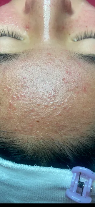 Tru Skin Acne Clinic Picture 10