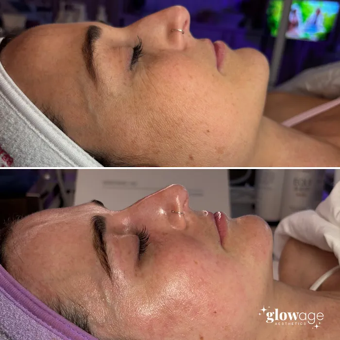 Glow Age Aesthetics Picture 9