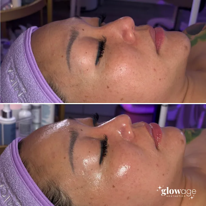 Glow Age Aesthetics Picture 10