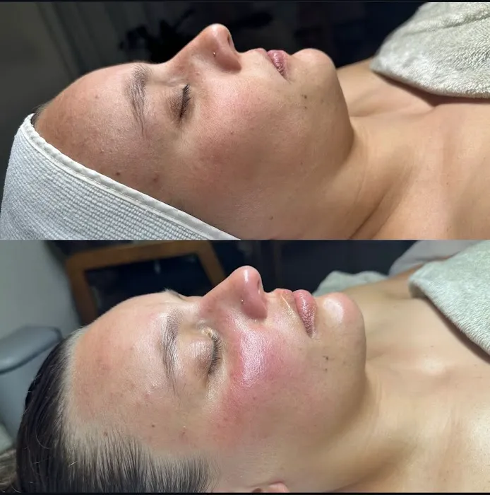 AMP Skin + Wellness Picture 5