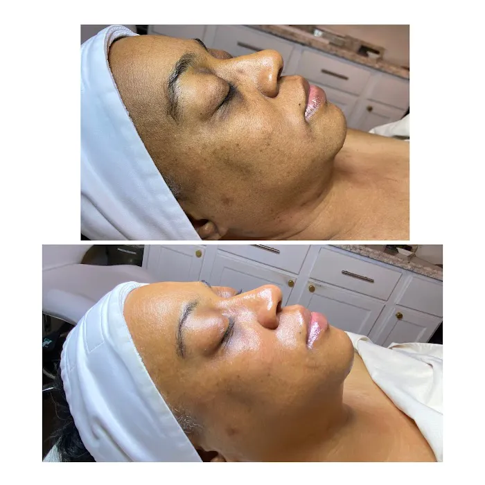 Bella TheSe Day Spa Picture 4